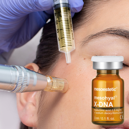 zalm dna r967jlgbo6tk750wj02onj75ho2qwy3vcwo822vibs